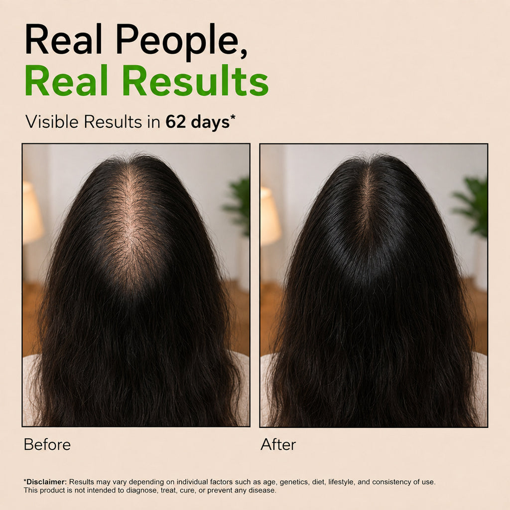 AVIRA Herbal Hair Oil