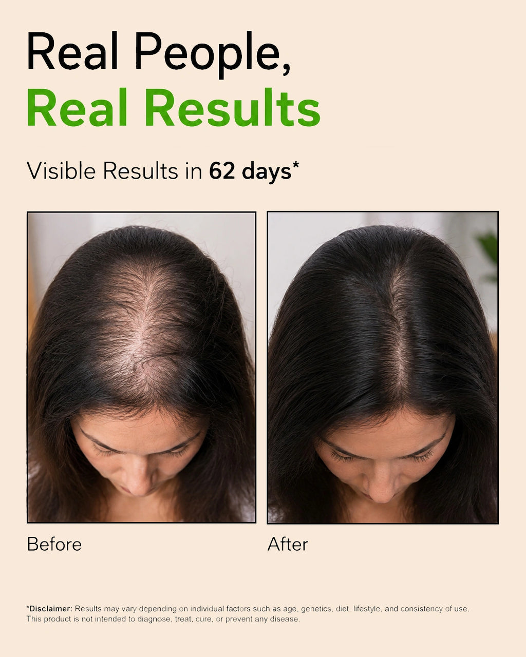 AVIRA Herbal Hair Oil